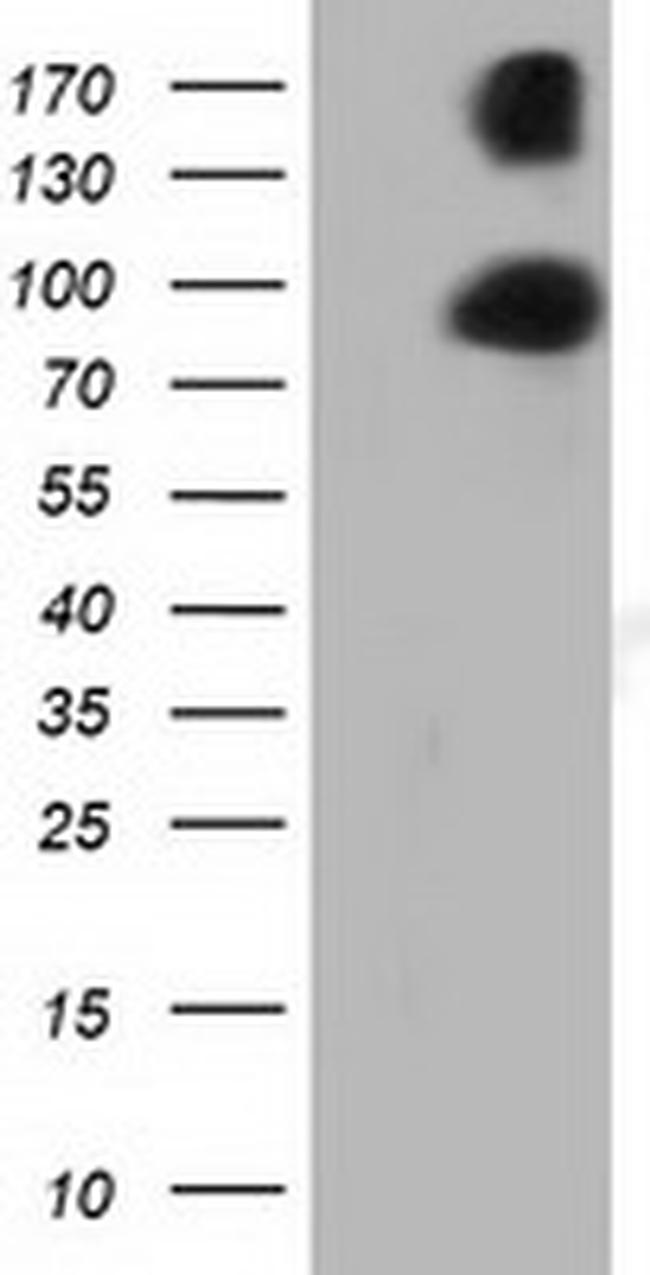 PRKD2 Antibody in Western Blot (WB)