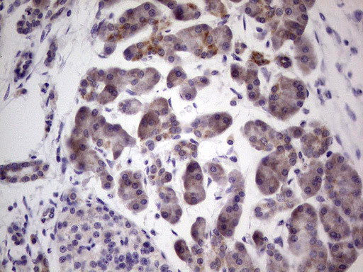 PRKD3 Antibody in Immunohistochemistry (Paraffin) (IHC (P))