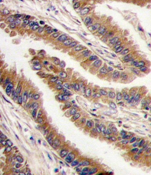 PRKX Antibody in Immunohistochemistry (IHC)