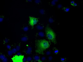 PRKY Antibody in Immunocytochemistry (ICC/IF)