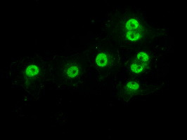 PRKY Antibody in Immunocytochemistry (ICC/IF)