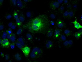 PRL Antibody in Immunocytochemistry (ICC/IF)