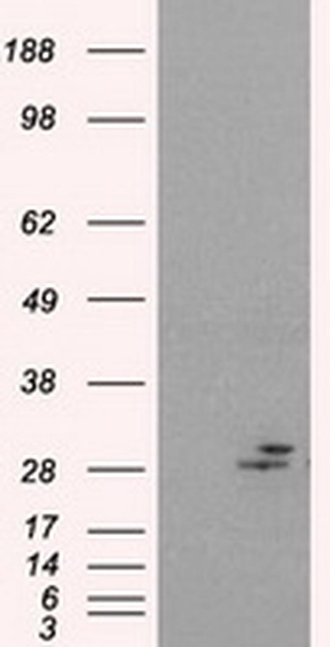 PRL Antibody in Western Blot (WB)