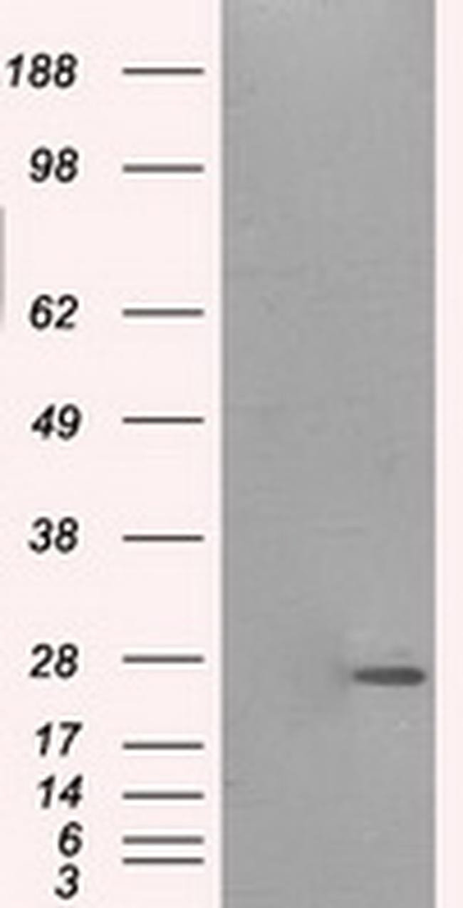 PRL Antibody in Western Blot (WB)