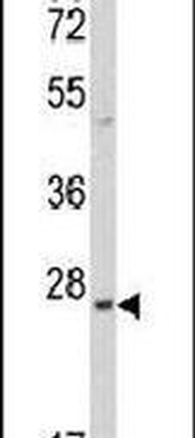 PRL3 Antibody in Western Blot (WB)