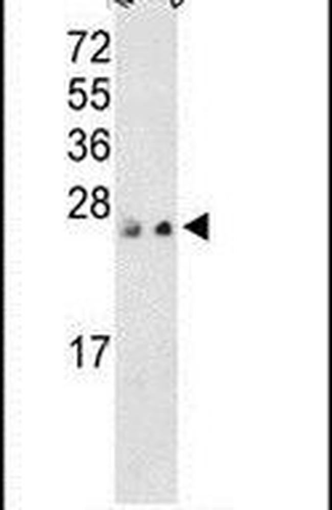 PRL3 Antibody in Western Blot (WB)
