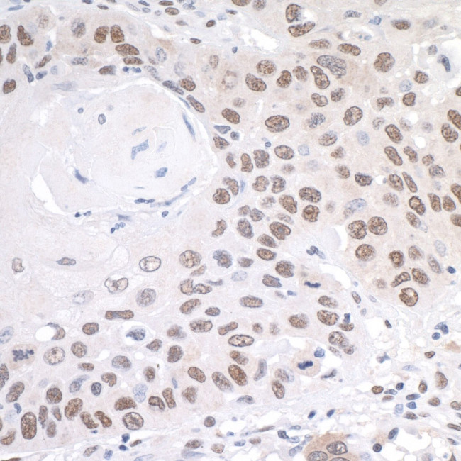 PRMT1 Antibody in Immunohistochemistry (IHC)