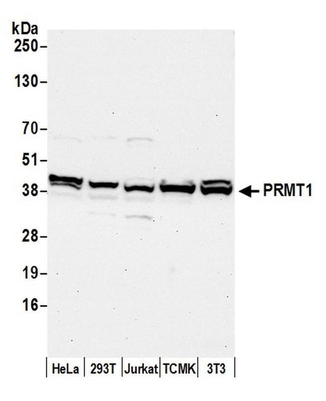PRMT1 Antibody in Western Blot (WB)