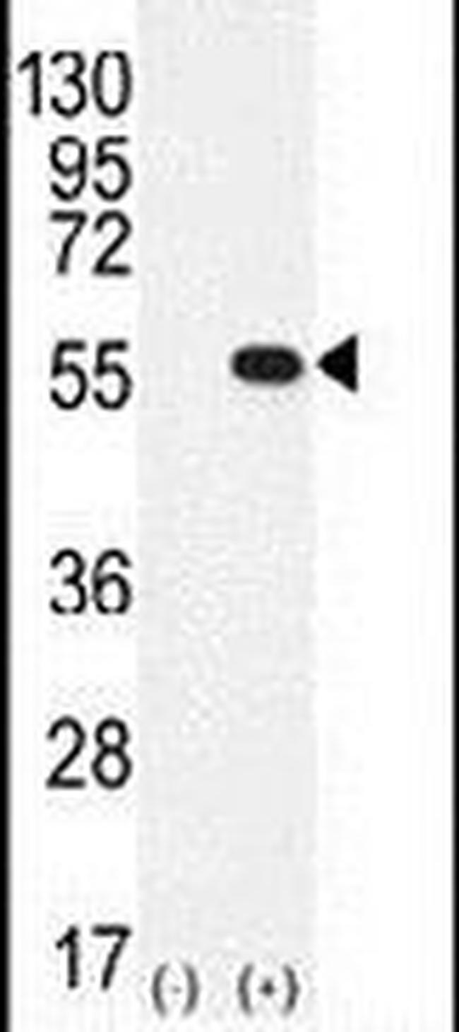 PRMT2 Antibody in Western Blot (WB)