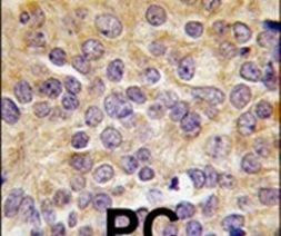 PRMT3 Antibody in Immunohistochemistry (IHC)