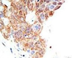 PRMT5 Antibody in Immunohistochemistry (IHC)
