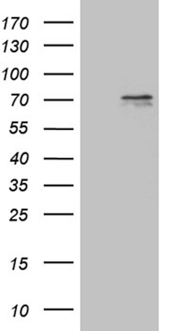PRMT5 Antibody in Western Blot (WB)