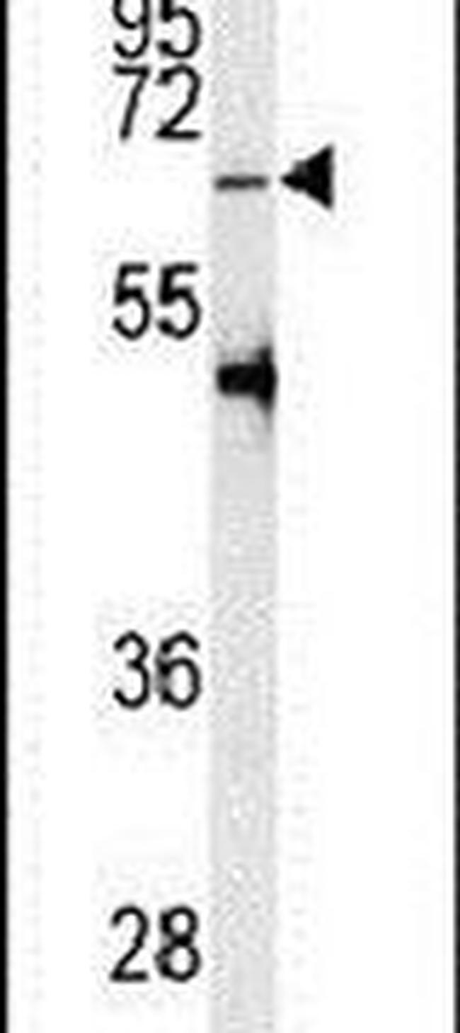 PRMT5 Antibody in Western Blot (WB)