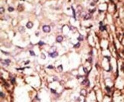 PRMT6 Antibody in Immunohistochemistry (IHC)
