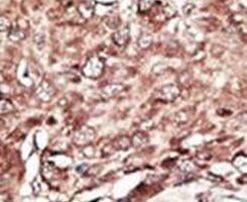 PRMT7 Antibody in Immunohistochemistry (IHC)