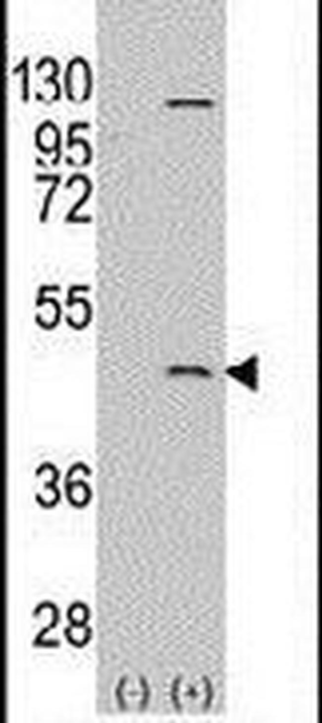 PRMT8 Antibody in Western Blot (WB)