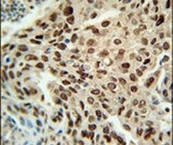 PRNPIP Antibody in Immunohistochemistry (IHC)