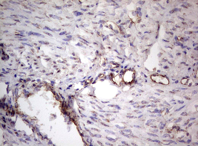 PROCR Antibody in Immunohistochemistry (Paraffin) (IHC (P))