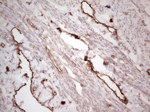 PROCR Antibody in Immunohistochemistry (Paraffin) (IHC (P))
