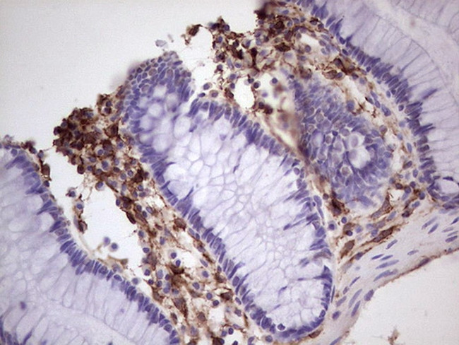 PROCR Antibody in Immunohistochemistry (Paraffin) (IHC (P))