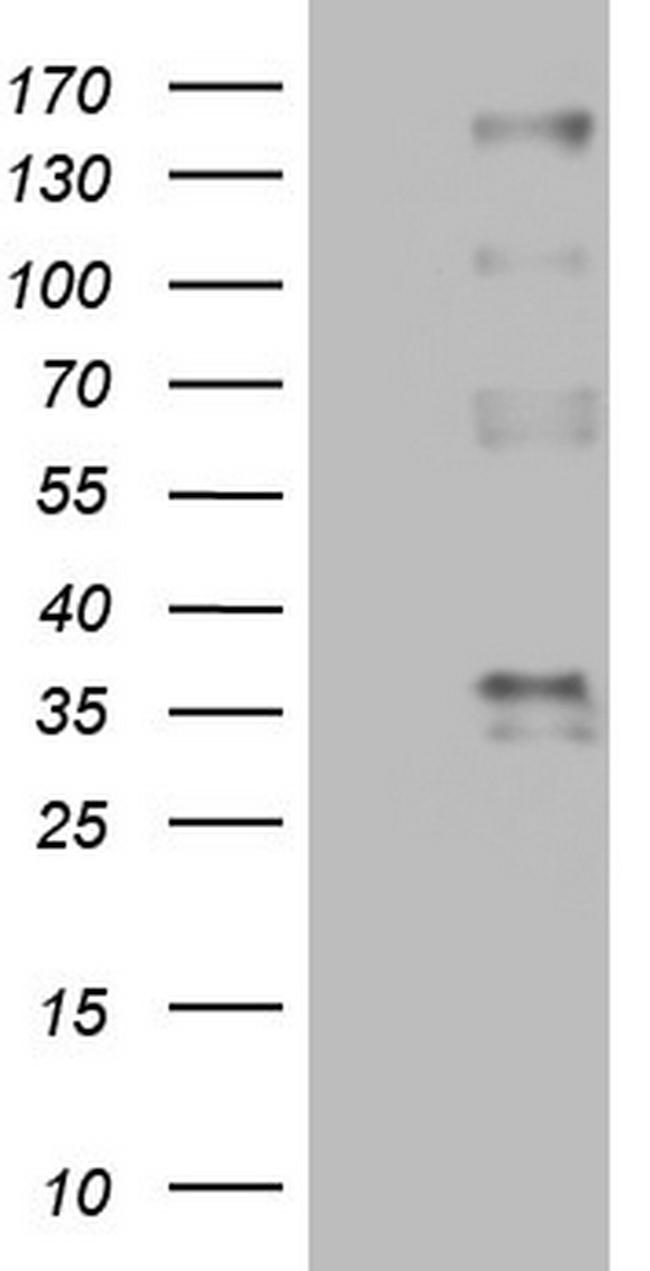 PROCR Antibody in Western Blot (WB)