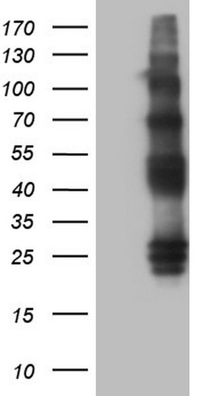 PROCR Antibody in Western Blot (WB)