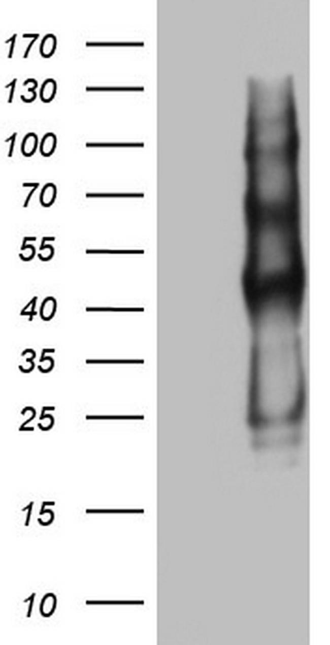 PROCR Antibody in Western Blot (WB)