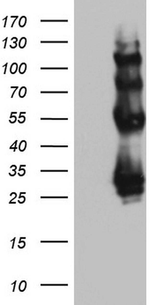 PROCR Antibody in Western Blot (WB)