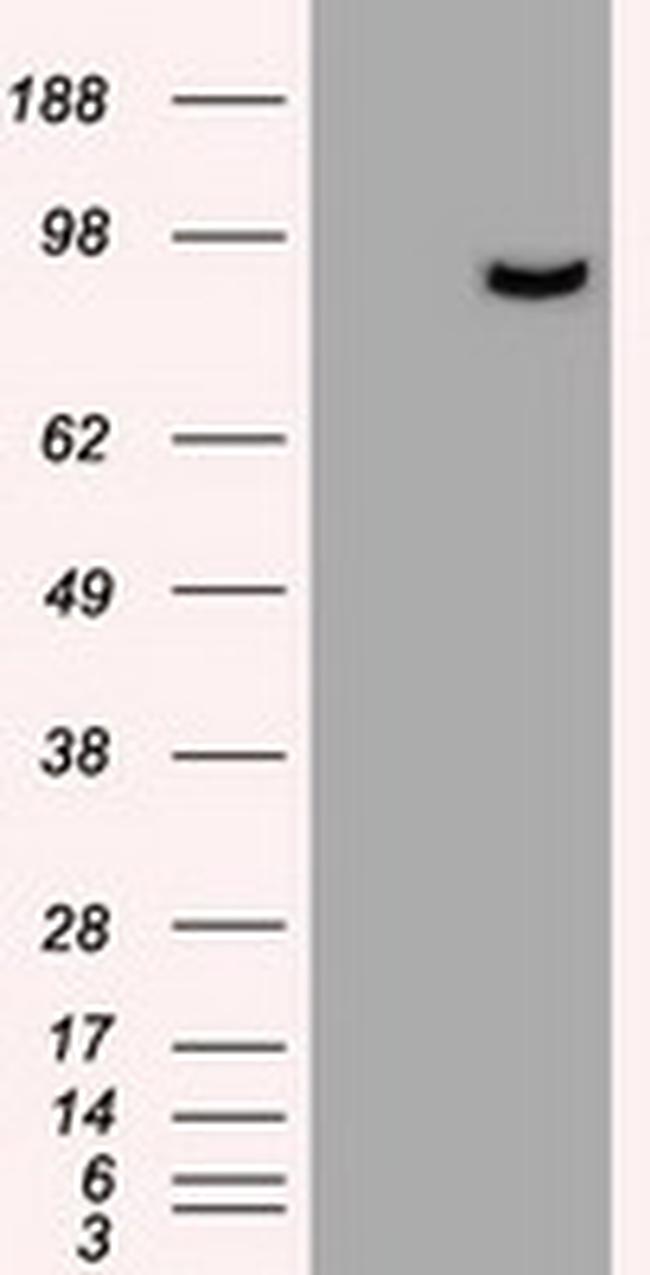 PROM2 Antibody in Western Blot (WB)