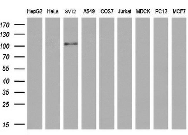 PROM2 Antibody in Western Blot (WB)