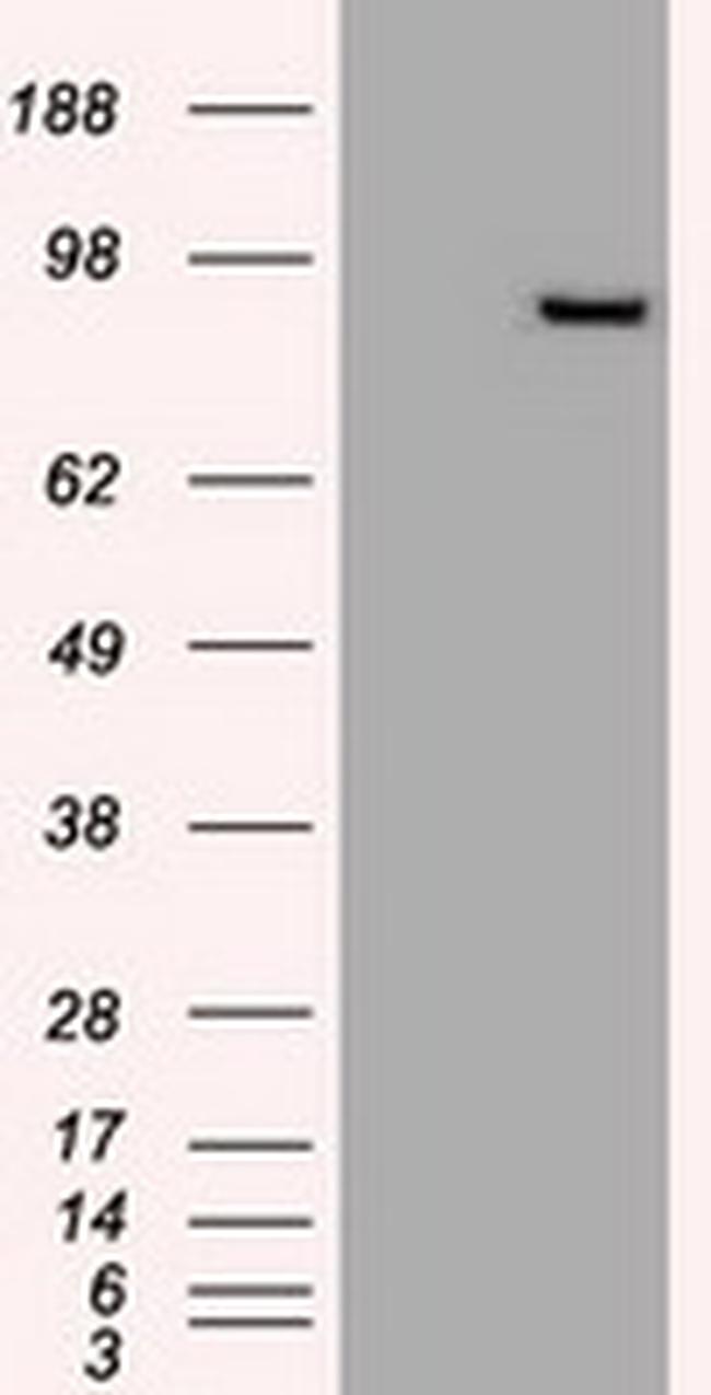 PROM2 Antibody in Western Blot (WB)
