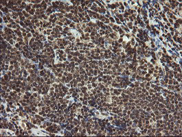 PROSC Antibody in Immunohistochemistry (Paraffin) (IHC (P))