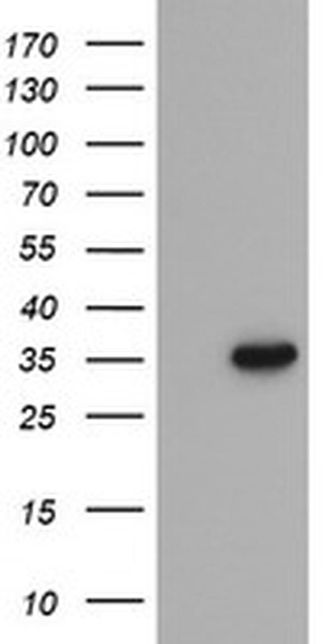 PROSC Antibody in Western Blot (WB)
