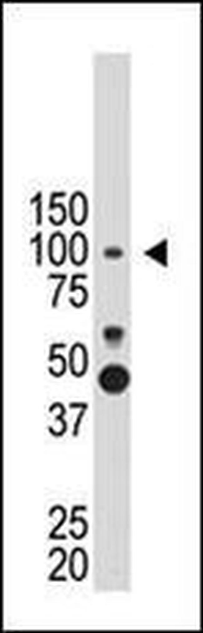 PROX1 Antibody in Western Blot (WB)