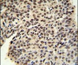 PRP19 Antibody in Immunohistochemistry (IHC)