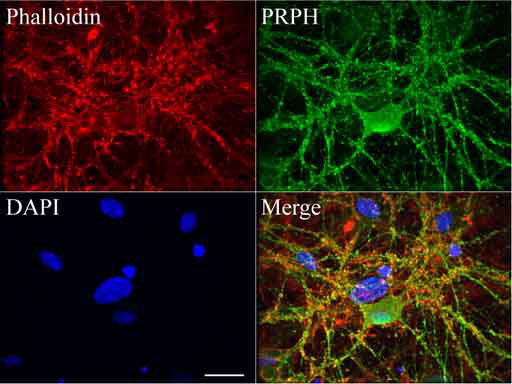 PRPH Antibody in Immunocytochemistry (ICC/IF)