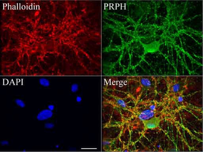 PRPH Antibody in Immunocytochemistry (ICC/IF)