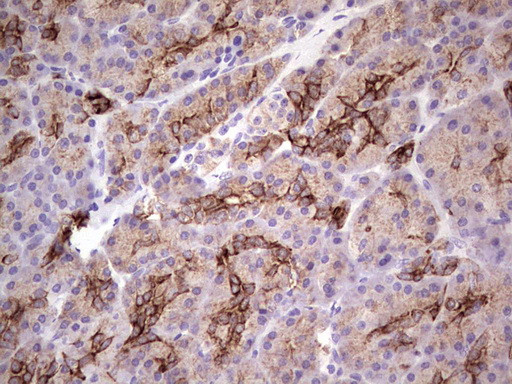PRPH Antibody in Immunohistochemistry (Paraffin) (IHC (P))