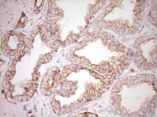PRPH Antibody in Immunohistochemistry (Paraffin) (IHC (P))