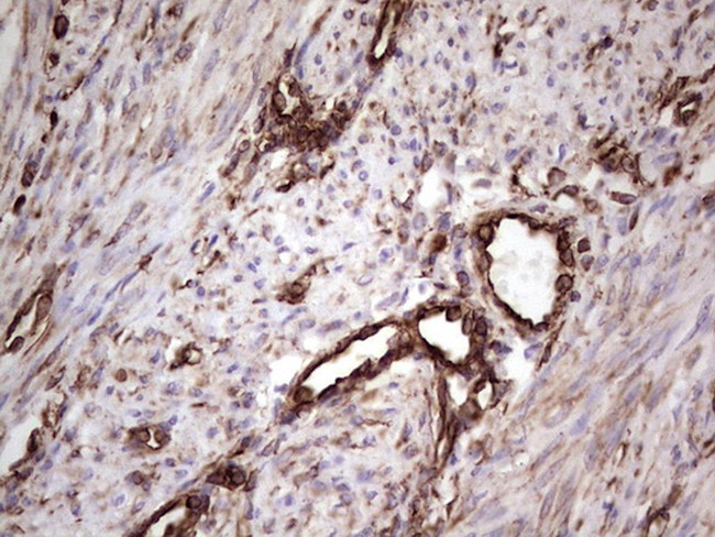 PRPH Antibody in Immunohistochemistry (Paraffin) (IHC (P))