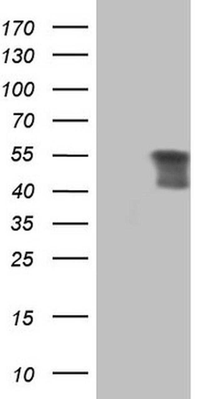 PRPH Antibody in Western Blot (WB)