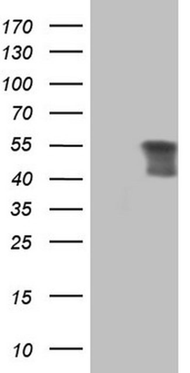 PRPH Antibody in Western Blot (WB)