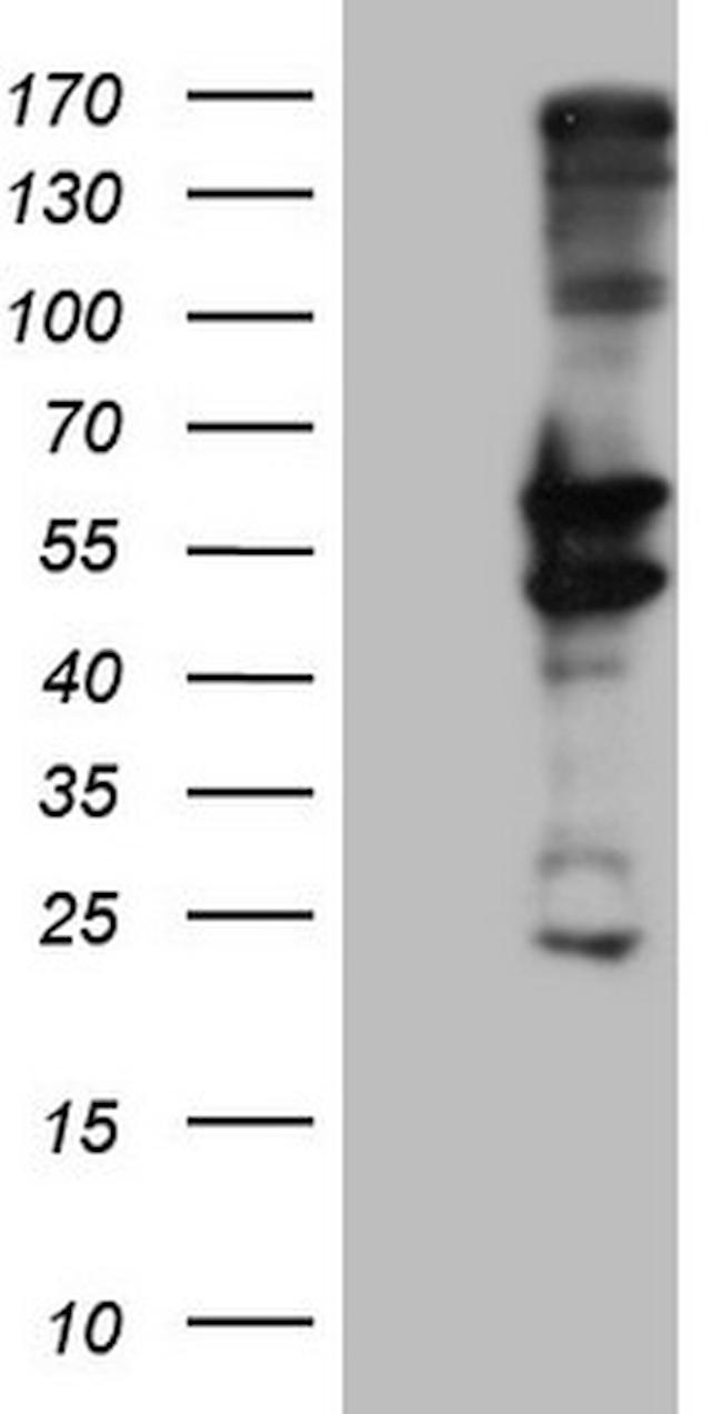 PRPH Antibody in Western Blot (WB)