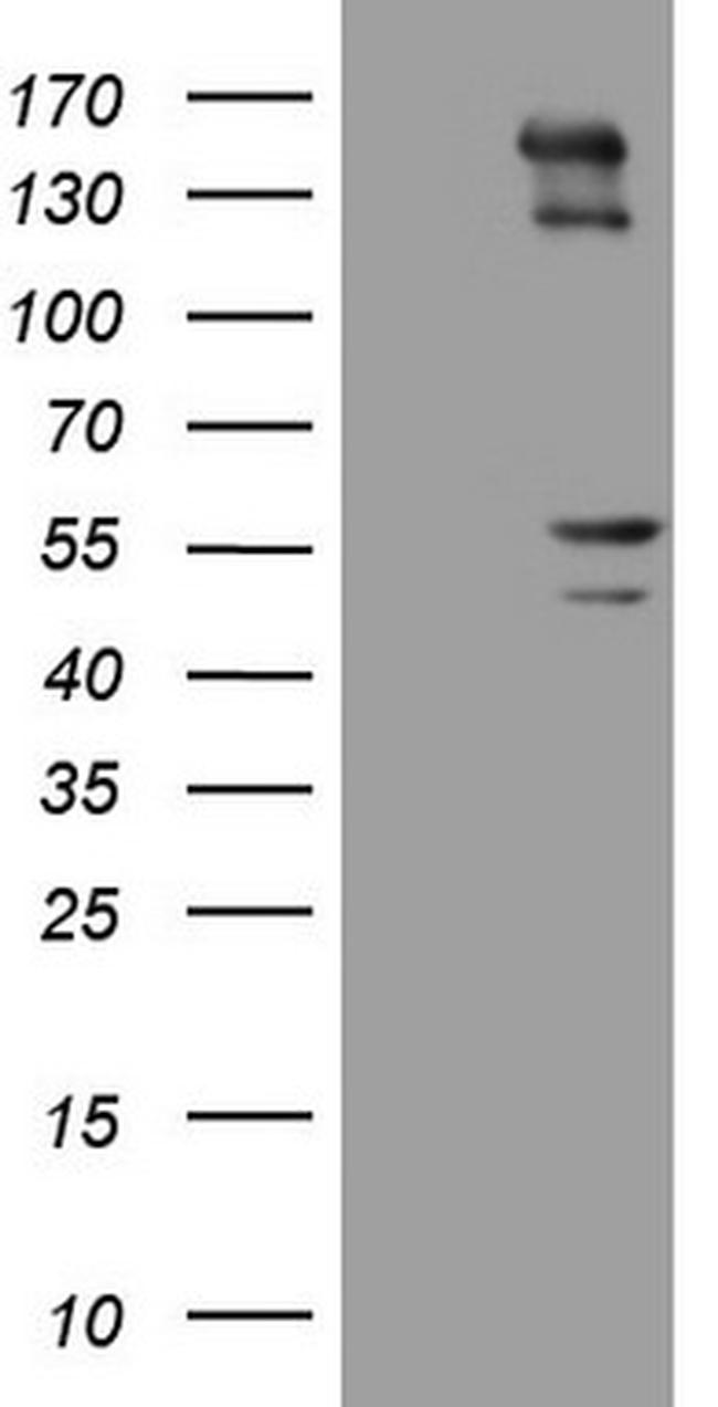 PRPH Antibody in Western Blot (WB)
