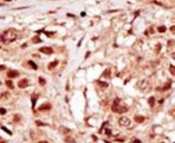 PRPK Antibody in Immunohistochemistry (IHC)