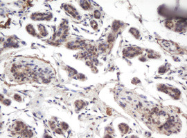 PRR11 Antibody in Immunohistochemistry (Paraffin) (IHC (P))
