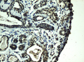 PRR11 Antibody in Immunohistochemistry (Paraffin) (IHC (P))