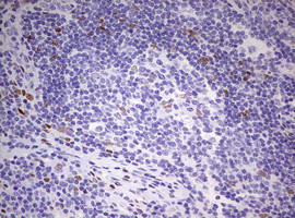 PRRX1 Antibody in Immunohistochemistry (Paraffin) (IHC (P))