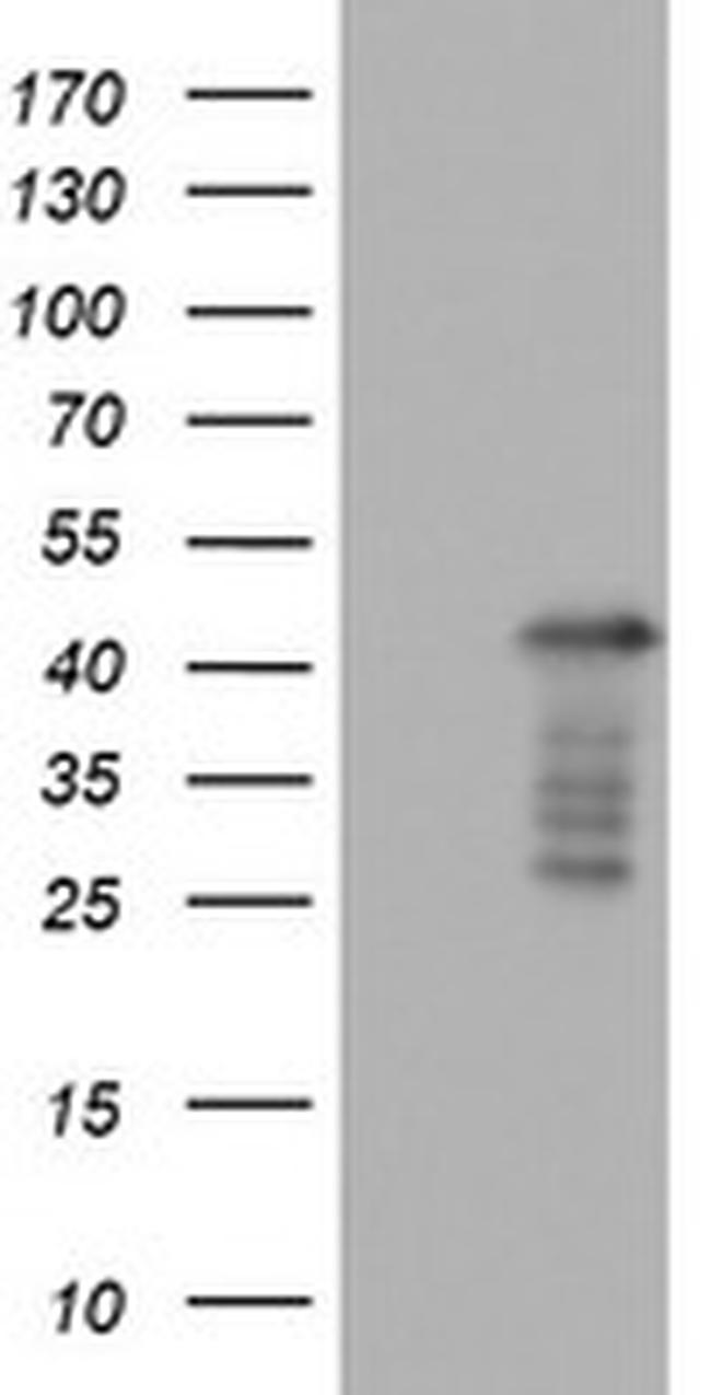 PRRX1 Antibody in Western Blot (WB)