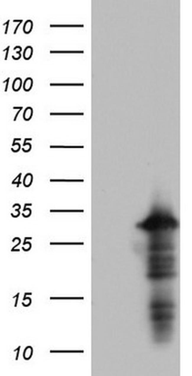 PRRX1 Antibody in Western Blot (WB)